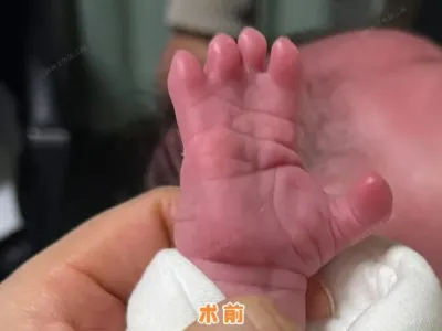 Dnes je to 152. den po operaci. Poslední kontrola-byla 47. pooperační den…