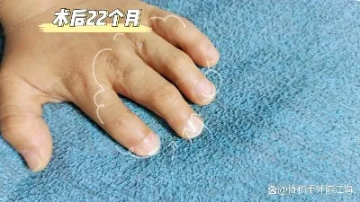 info-1242-699 info-1242-699