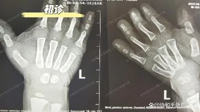 info-1242-699 info-1242-699