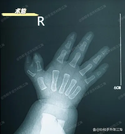 info-1038-1114 info-1038-1114